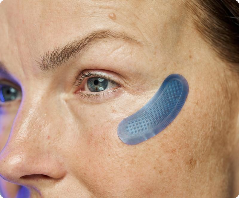 Micro-Infusion Targeted Patches