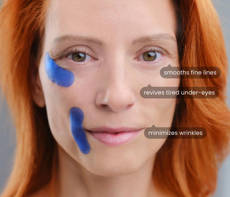 Micro-Infusion Targeted Patches